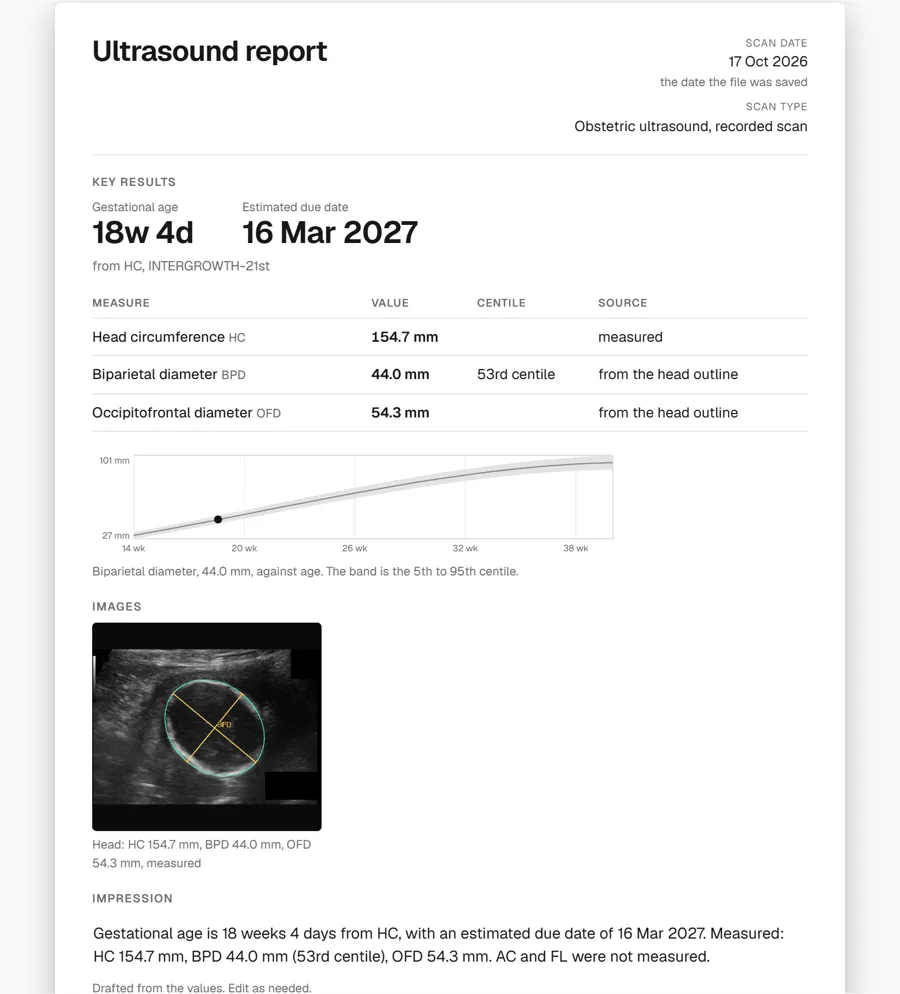 A one-page report exported from the captured study.